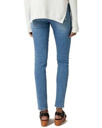 Topshop Moto Ripped Skinny Jeans