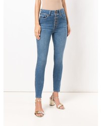 Alice + Olivia Aliceolivia Button Front Skinny Jeans