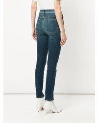 Frame Denim Ankle Zip Skinny Jeans
