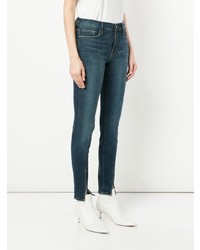 Frame Denim Ankle Zip Skinny Jeans