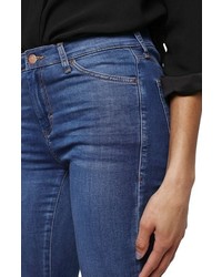 Topshop Leigh Ankle Skinny Jeans