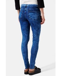 Topshop Moto Leigh Ankle Skinny Jeans