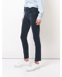 Mother Distressed Detail Skinny Jeans