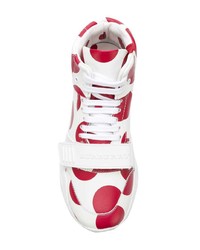Burberry Spot Print Leather High Top Sneakers